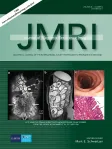 Journal of Magnetic Resonance Imaging cover