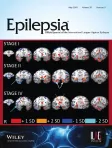 Epilepsia cover