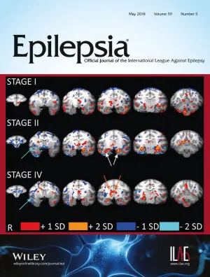 Epilepsia cover