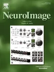 NeuroImage cover