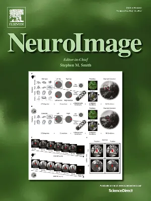 NeuroImage cover