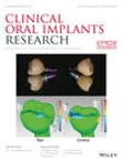 Clinical Oral Implants Research cover