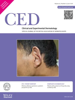 Clinical and Experimental Dermatology cover