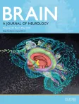 Brain cover
