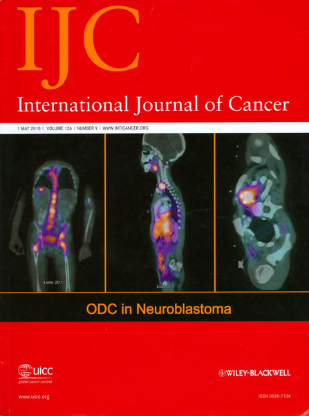 International Journal of Cancer 封面图